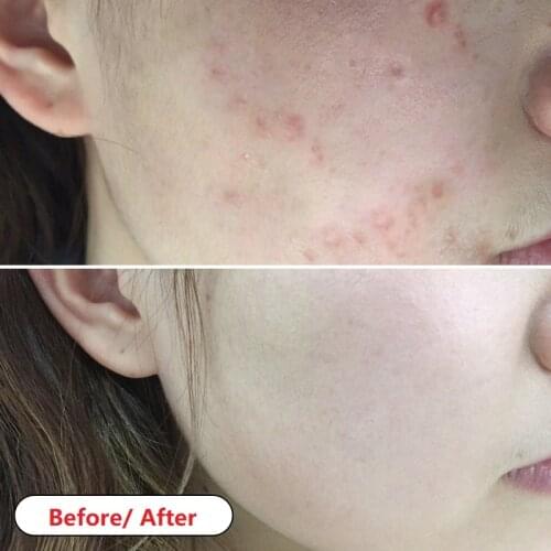 JYP Sunscreens For The Face