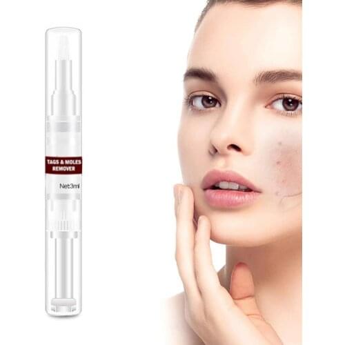 1 Piece Wart Corn Remove Moles Remover Liquid Wart Removal Pen Genital Wart Treatment Body Care Pen3ml