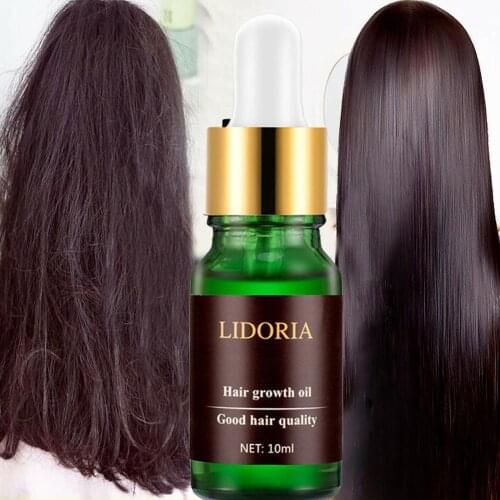 100% Natural Ginger Extract Oil Plant Nutrition Liquid Re Grow Oil Loss Treatement 7 Day Germinal Hair Growth Serum HairDressing