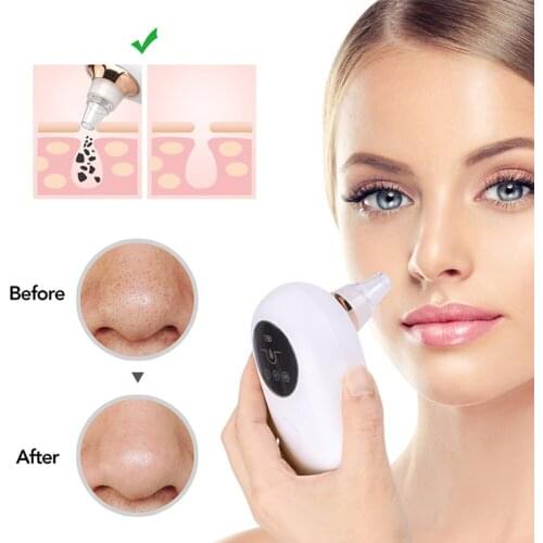 Blackhead Remover Electric Black Dot Vacuum Cleaner Skin Care Tools Black Spots Pimple Acne Removal Pore Vacuum Beauty Machine