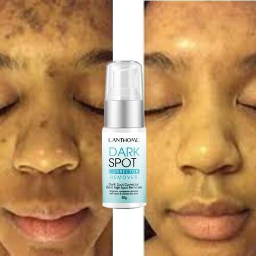 Lanthome dark spot cream remover corrector to whiten and moisturize, improve skin barrier 30g