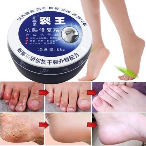 88g Crack Cream Moisturizing Refreshing Skin Care Hand Foot Heel Chapped Repair Powerful Peeling Anti-dry Bleeding Treatment