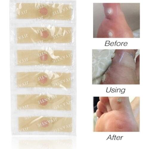 42pcs Foot Plaster Corn Removal Pads Medical Plasters Warts Thorn Patch Curative Patches Calluses Callosity Detox Foot Patches