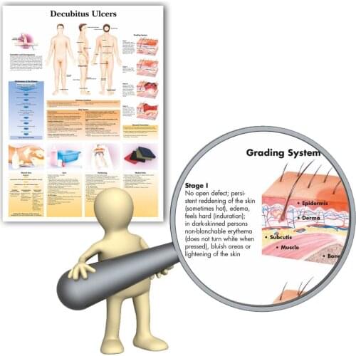 WANGART Decubitus Ulcers Chart Art Poster Print Body Map Canvas Wall Pictures for Medical Education Home Decor
