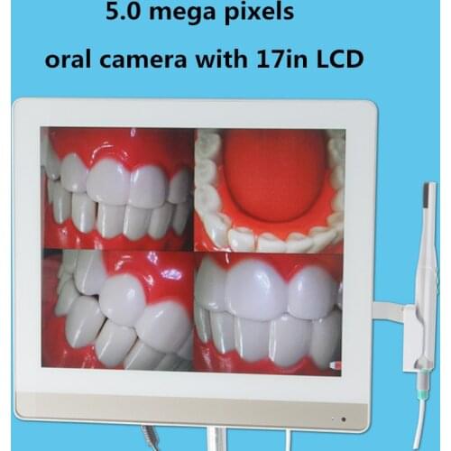 2016 New Arrival 5.0 mega pixels 17inch LCD monitor with usb intra oral camera all in one machine Dental endoscope