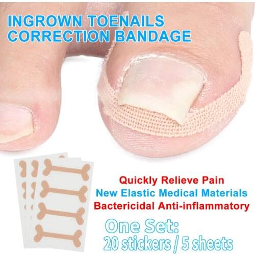 20pcs ingrown toenails band Aid relief pain Paronychia correction pedicure Elastic Force Sticker Repair bandage toe nail care