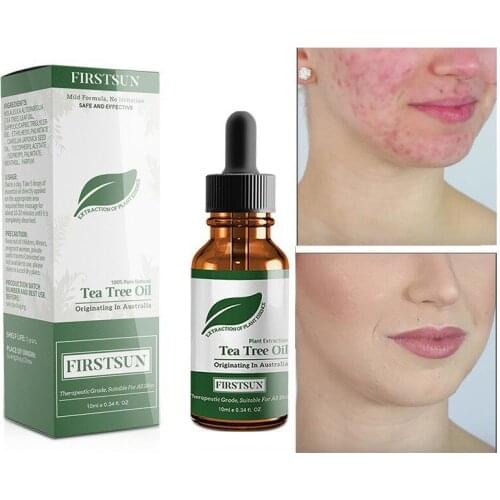 Natural Tea Tree Massage Oil Moisturizing Oil-Control Desalination Balance Shrinkage Pore Repair Essential Oil 2019