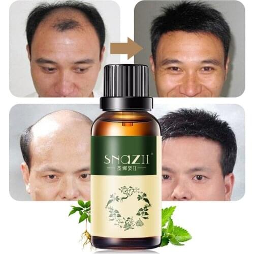 Powerful Hair Growth Essence Hair Loss Products Ginger Original 100% Hair Loss Liquid Health Care Hair Essence Oil 30ml