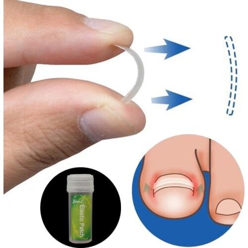 10pcs/pack Toenail Straightening Clip Ingrown Toenail Correction Tool Nail Treatment Elastic Patch Sticker Foot Care Pedicure