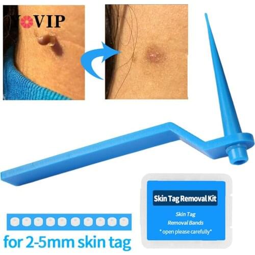 Micro Band Non Toxic Face Care Mole Wart Tool For Small To Medium Blue Skin Tag Removal Kit With Cleansing Swabs Home Use Adult