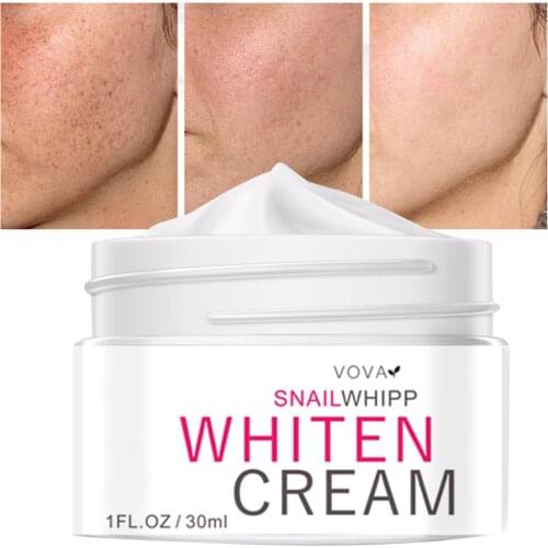 VOVA Dark Spots Remover for Face Dark Spots Corrector Cream Face Cream for Age Spot Skin Whitening Cream for Men Women