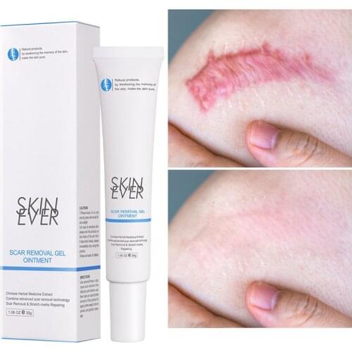 Acne Scar Removal Cream Gel Stretch Marks Pimples Scald Scar Remover Cream Smoothing Whitening Moisturizing Body Cream Skin Care