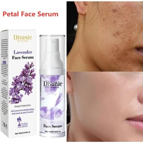 Lavender Rose flower petals Whitening Face Serum Lighten Spots Brightening Facial Skin Essence Fade Dark Spots Remove Freckle