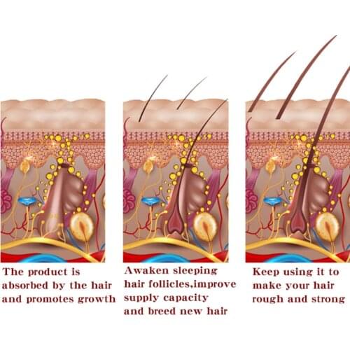 Лосьоны после бритья Y&W&F China At AliExpress