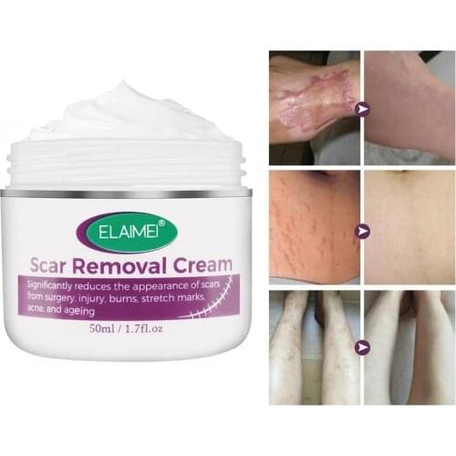Skin Rebound Scarless Cream Scar Removal Cream Face Cream For Face Acne Scar Stretch Marks Skin Repair Face Cream