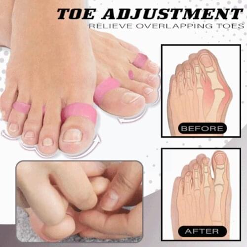Dashan Beautiful Leg Toe Ring Foot Thumb 0 Leg Toe Toe Thin Ring Foot Ring Tool Ring Thin Toe Shape Toe Ring For Correcting K9m6