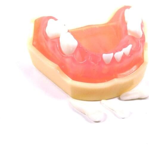 1 Piece Dental Model Study Typodont Standard Orthodontic Brackets Wires Tie Anchor Screw Dentist School Training