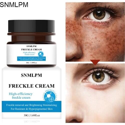 SNMLPM 30G Anti Aging Face Cream Dark Spot Remover Skin Lightening Cream Dark Skin Care Anti Freckle Face Care Whitening Cream