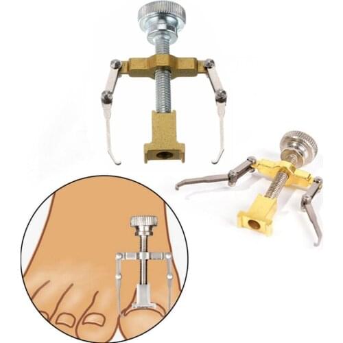 Pro Foot Nail Care Orthotic Nail Bunion Corrector Ingrown Toe Nail Correction Tool Pedicure Fixer Significant recovery effect