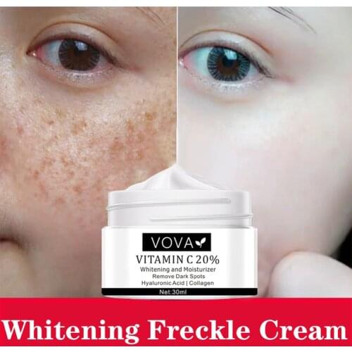 Facial Cream Skin Care Cream Rich in Vitamin C for Removing Dark Spots Freckles Brightening Skin Moisturizer for All Skins