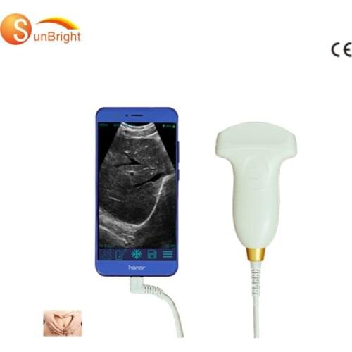 Type C phone Ultrasound sensor 128 elements clear images cheapest ultrasound convex probe