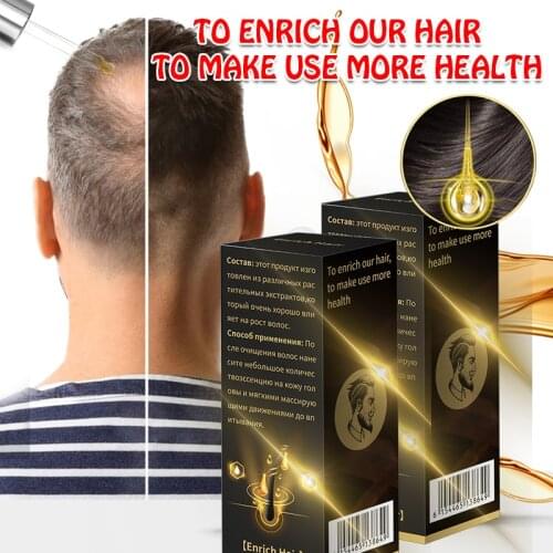 GIOIO Hair Loss Remedies