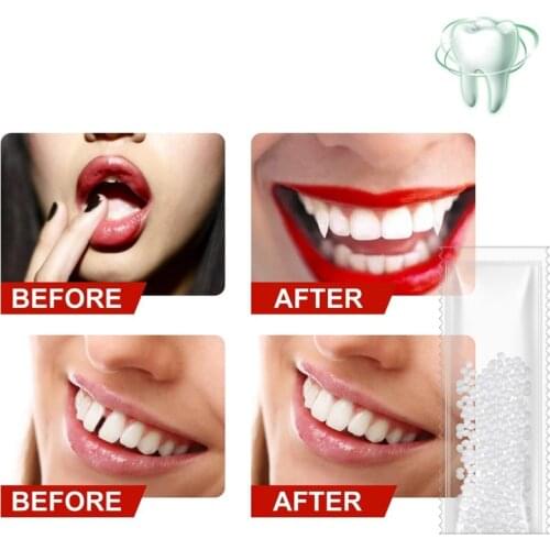 5-20g Repair Temporary Teeth Gap Falseteeth Solid Resin Glue Teeth Whitening BeautyReusable Dentist Denture Adhesive Veneers