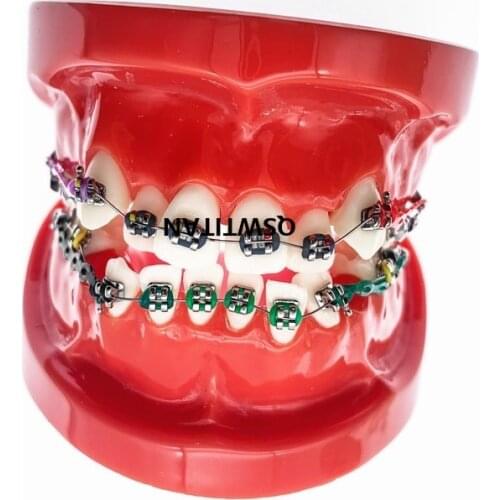 Dental Orthodontic Teeth Study Model 3005 Red With Brackets Chain Ties Arch Wire