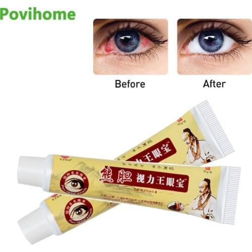 1Pcs 30g Eye Protection Ointment for Eye Fatigue Improve Vision Cream Eyes Beauty Care Oil Chinese Herbal Medical Plaster Health