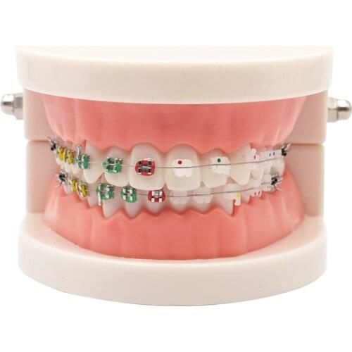 1pc Dental Orthodontic Treatment Model With Ortho Metal Ceramic Bracket Arch Wire Buccal Tube Ligature Ties Dental Lab Tools