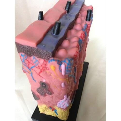 Cutaneous Anatomical Model Acne Epidermal Anatomy Human Medical Teaching Model Skin Structure Anatomy Cosmetic Training Aids