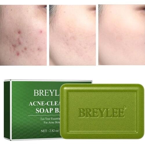 Tea Tree Essential Oil Soap Face Back Arm Acne Skin Treatment Oil Control Anti Bacterial Remove Mites Plant Handmade Foam Soap