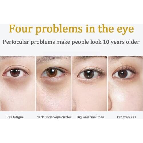 Colorful Eye Mask Moisturizing, Moisturizing And Diminishing Circles Eye Dark Care Products Skin Patch K5G7