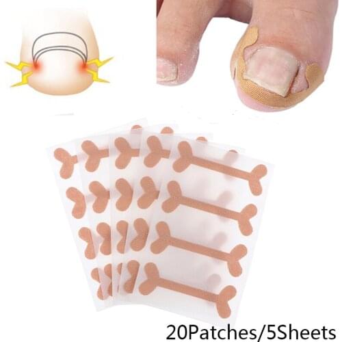 20pcs Professional Ingrown Toenail Foot Corrector Stickers Elasticity Toe Nail Care Pedicure Tools Health Care Protects Toe Nail