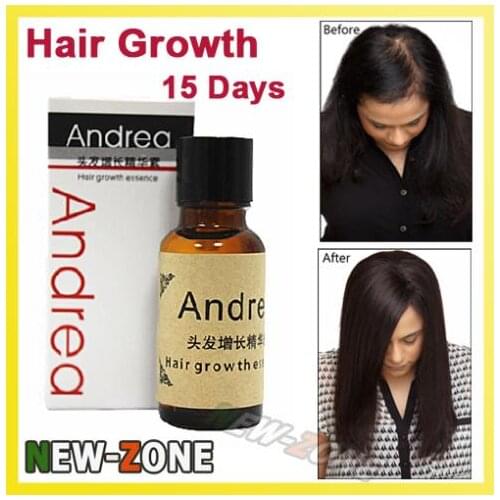 Fast Hair Growth Solution Essence Liquid for all hair loss type 20ML Hair Treatment 100% Natural Herbal Healthy