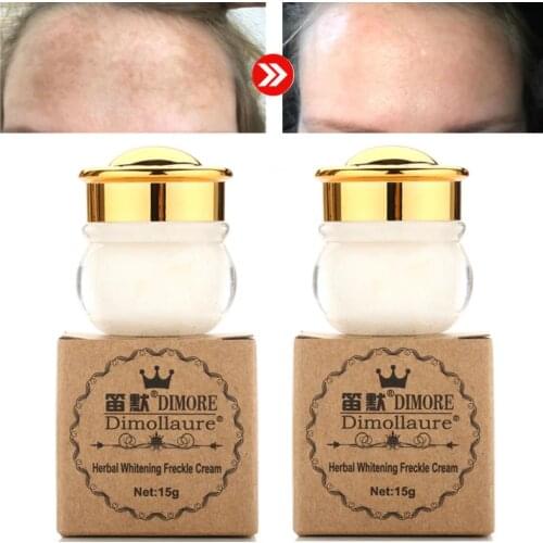 Dimollaure Face Whitening Cream Scar Removal Melasma Freckle Speckle Sunburn Spots Pigment Melanin Cream Dimore Whitening Cream