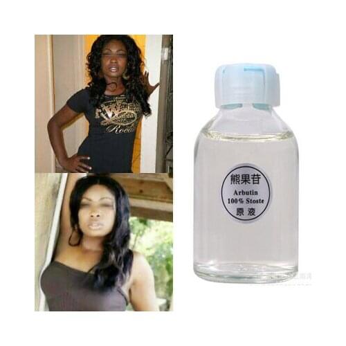 Skin Whitening cream for for dark skin Lightening Brightening Serum Kojic Acid Serum Bleaching Cream