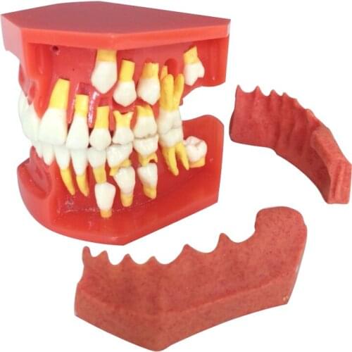 Dental tooth model Primary Permanent Tooth Model Alternative Deciduous Teeth Model For Studying Teaching Demonstration