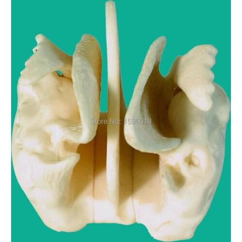 Amplified Ethmoid Bone model,Ethmoid amplification model,Ethmoid Bone model