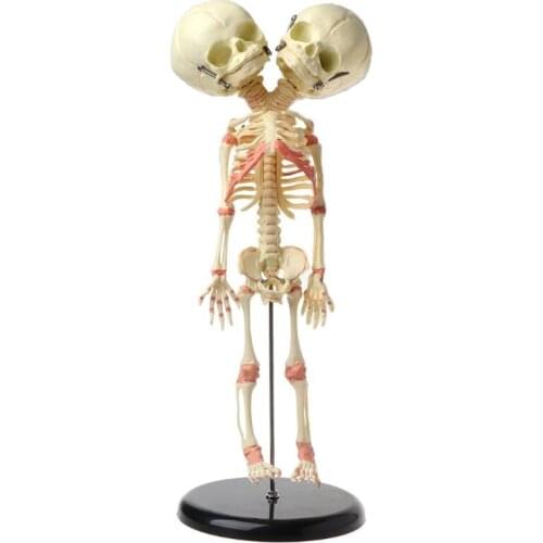 37cm Human Double Head Baby Skull Skeleton Anatomy Brain Display Study Teaching Anatomical Model