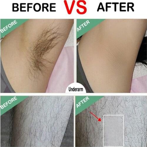 24 Pcs Hair Removal Depilatory Nonwoven Epilator Cold Wax Strip Paper Pad Patch Waxing for Body Bikini Face Armpit Legs