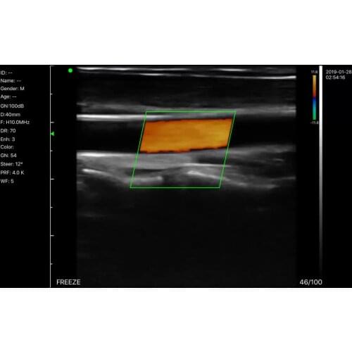 Handheld Ultrasound Linear Array Scan Device-Beijing Konted C10CX Portable B Ultrasound