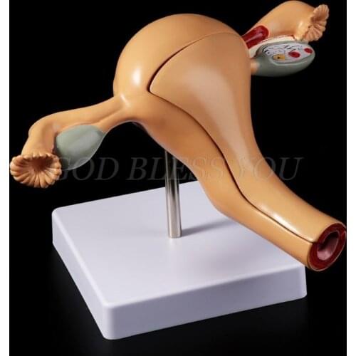 Human Pathological Uterus Ovary Model Anatomical Anatomy Disease Pathology Lesion For Teaching Drop Shipping