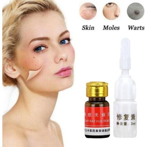 Mole Water Moisturizing Tag Remover Serum Mole Removal Removal Solution Skin Tool Face Cream Repair L Solution Care Care O4H3