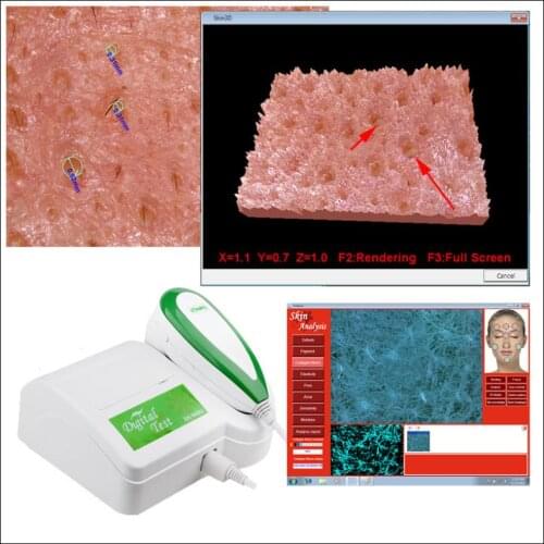 HD 5 million pixels facial skin analyzer detector Skin Scope Oily Acne Moisture Comprehensive Skin Analysis for Beauty spa