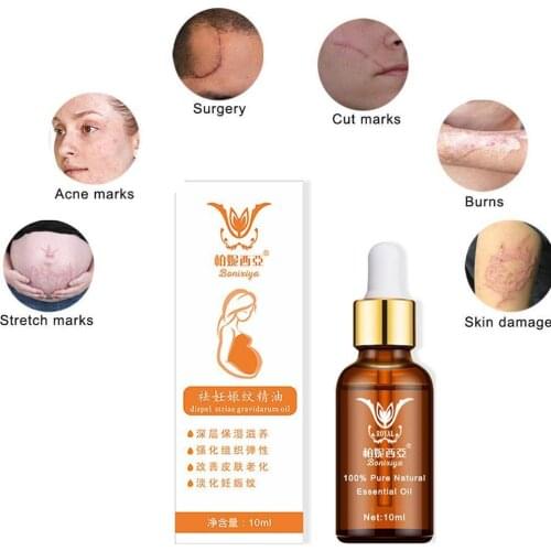 Stretch Marks Remover Essential Oil Eliminate Pregnancy Winkle Firming Treatment Repair Anti Maternity Skin Scars S0G1