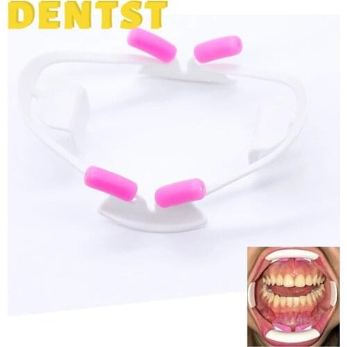 Dentst 3D Oral Dentisa Mouth Opener Dental Instrument Lip Retractor Orthodontic Professional Dentist Tools Dentistry Materials
