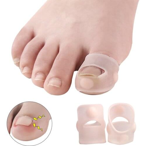 1Pair Silicone Ingrown Toenail Correction Tool Invisible Ingrown Toe Nail Treatment Elastic Straightening Clip Brace