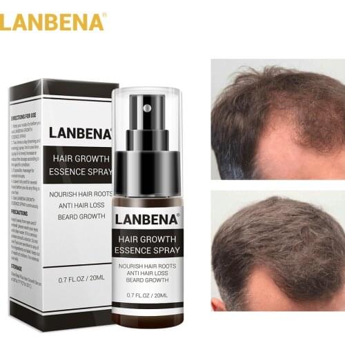 LANBENA Powerful Hair Growth Ginger Extract Essential Oil Treatment Anti Hair Loss Nourishing Anti-Drying Hair Care Product 20ml