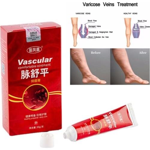 Varicose Veins Treatment Cream Varicosity Angiitis Remedy Ointment Relief Veins Pain Phlebitis legs Varicose Veins Cream 30g